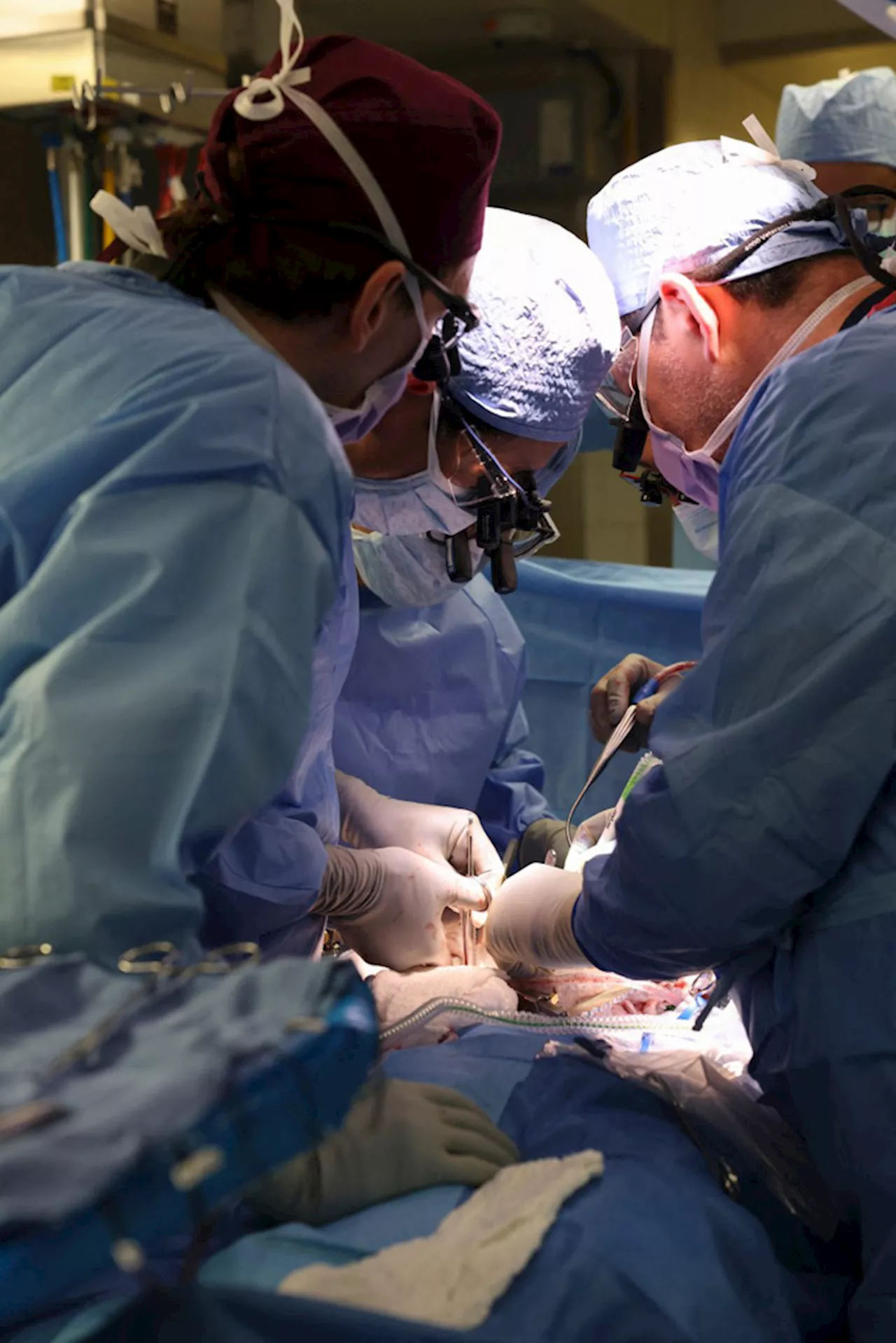 #ANONGBALITA Surgeons transplant pig kidney to live patient in world first