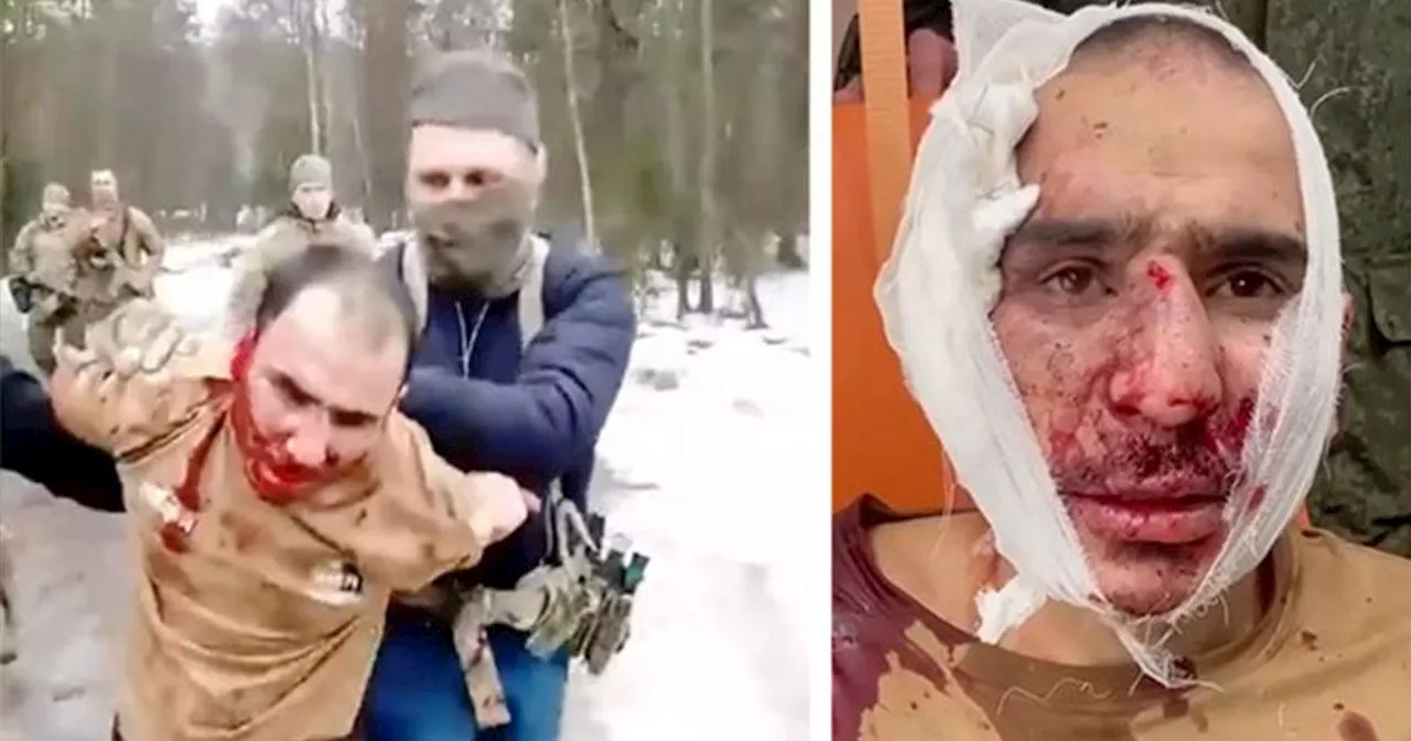 Skär av terroristens öra efter gripandet: ”Ät din jävel”