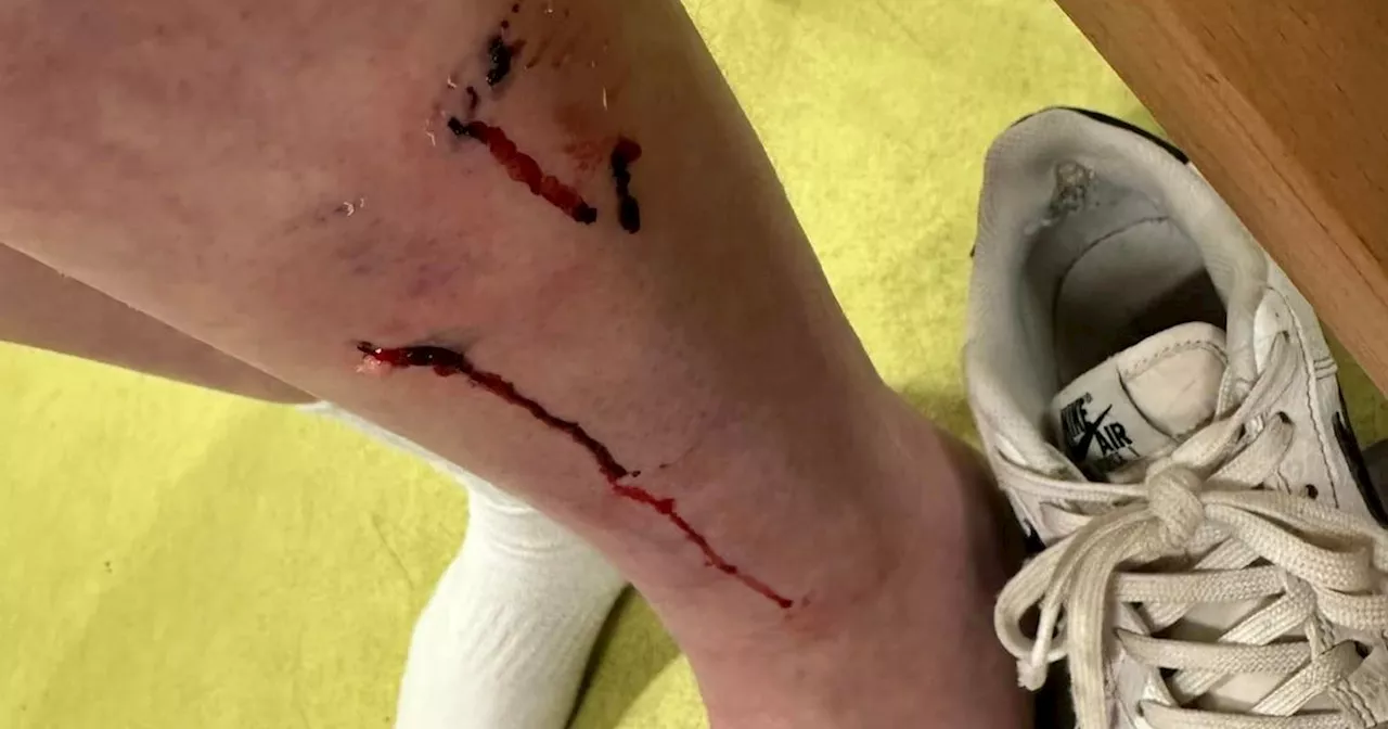 Schoolgirl attacked by dangerous dog in skatepark