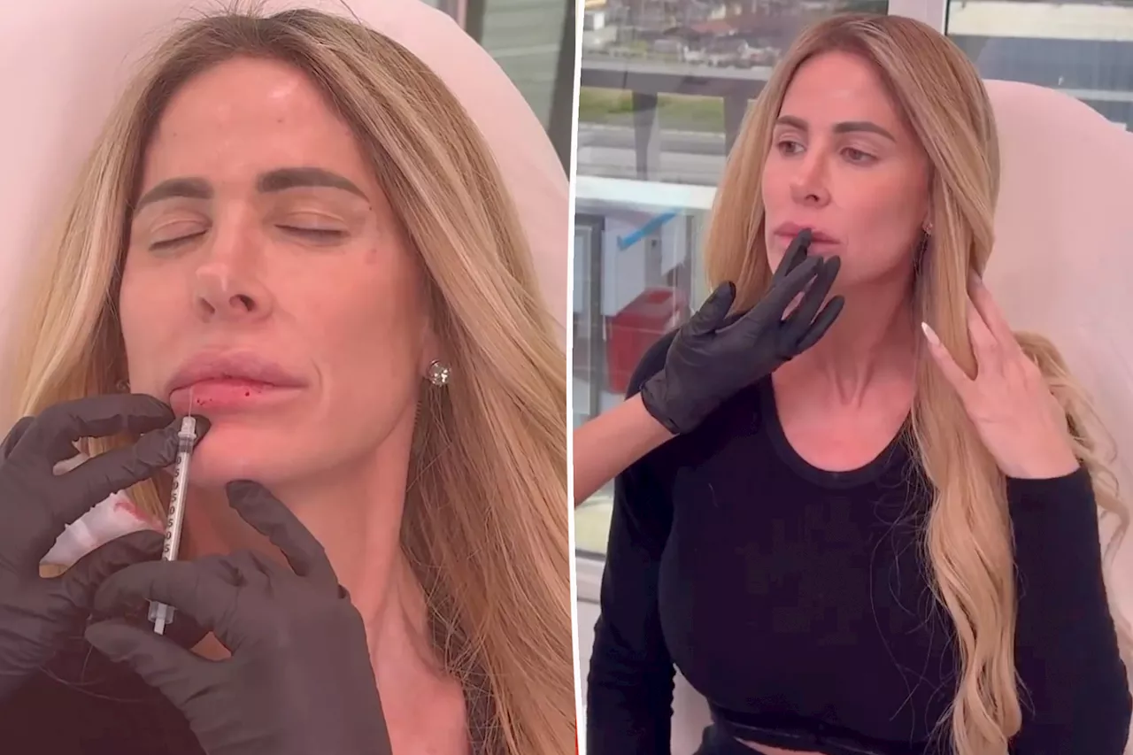 Kim Zolciak roasted for getting lip fillers, Botox amid alleged financial woes: 'You are in debt up to your eyeballs'