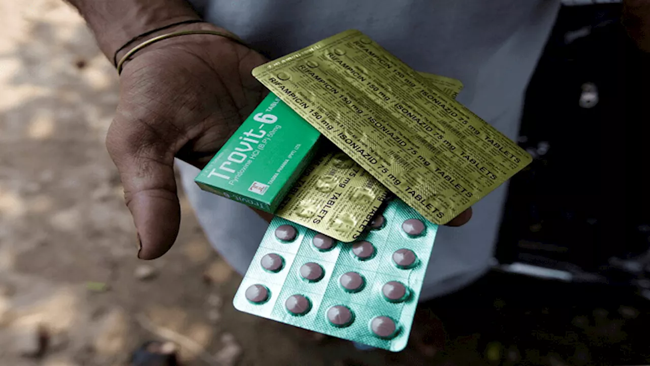 TB patients urged to continue taking their daily medication - SABC News - Breaking news, special reports,