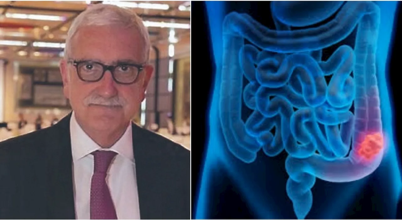 Tumori gastrointestinali, l'oncologo Francesco Cognetti: «Attenzione ai sintomi come gonfiore addominale e san