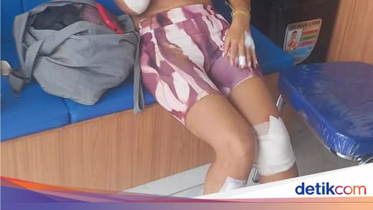 Bule Spanyol Dijambret, Pelaku Tinggalkan Motor Seusai Rampas Kalung Imitasi