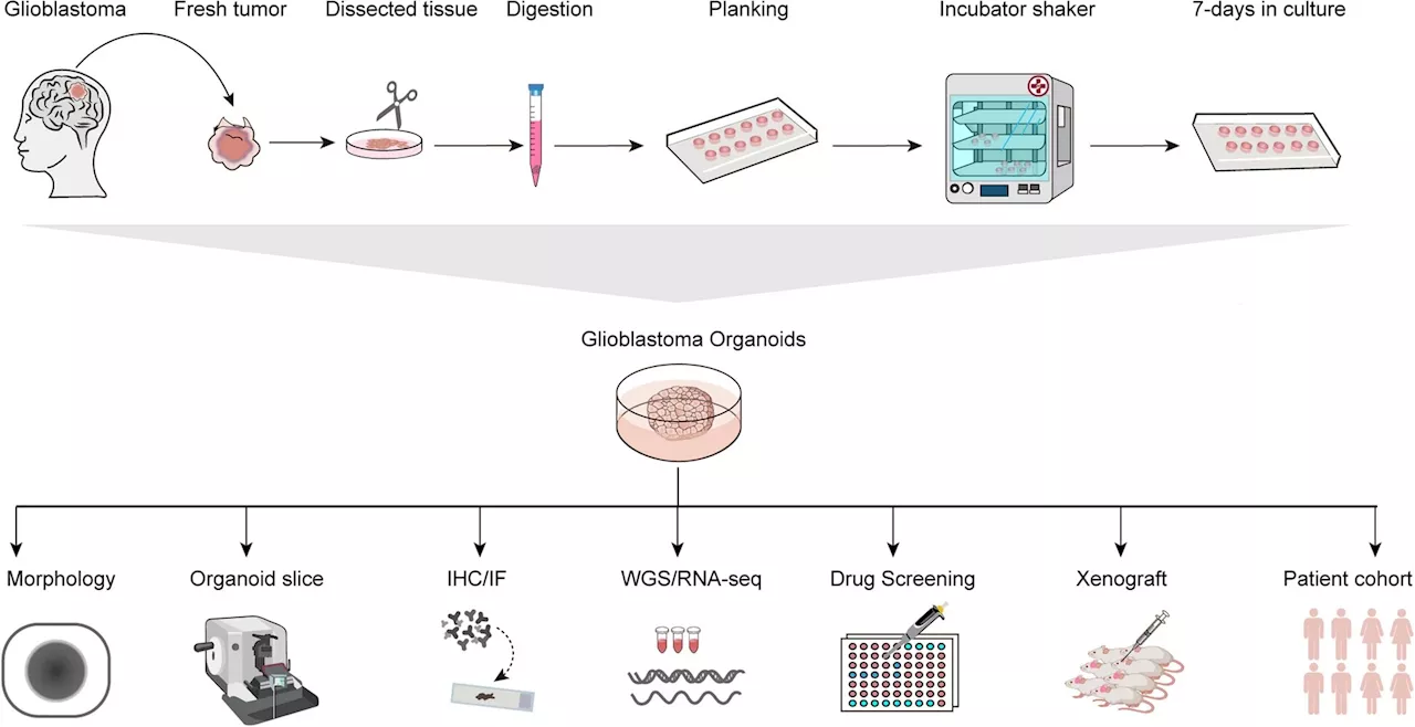 Patient-derived organoids in human cancer: A platform for fundamental research and precision medicine