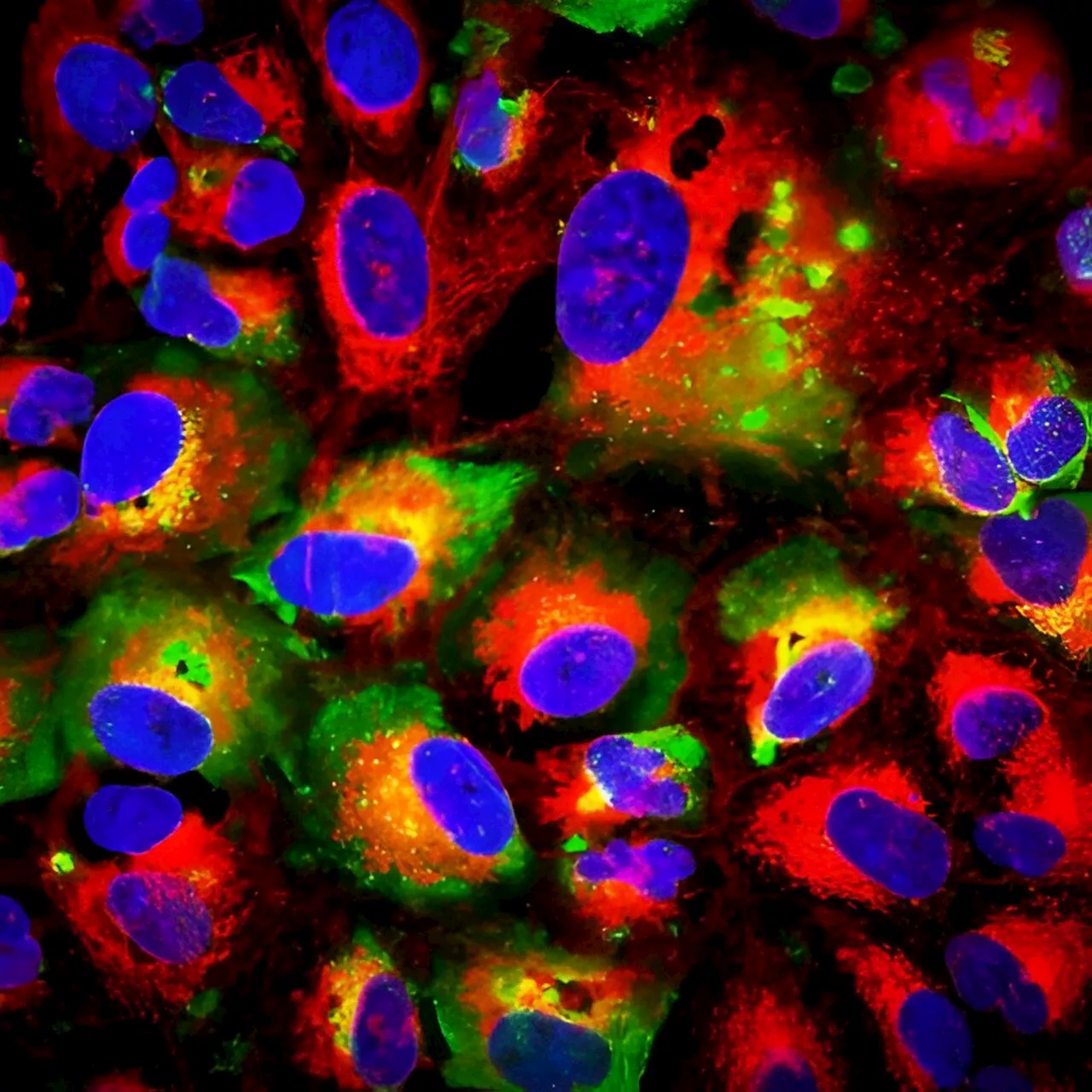 Novel protective antibody target identified against Crimean-Congo hemorrhagic fever virus