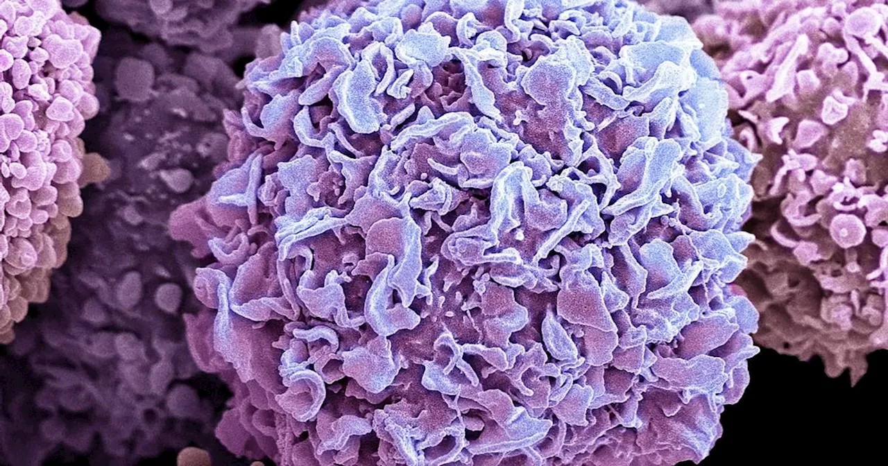 Breast cancer breakthrough could stop 'hibernating' cells causing relapses