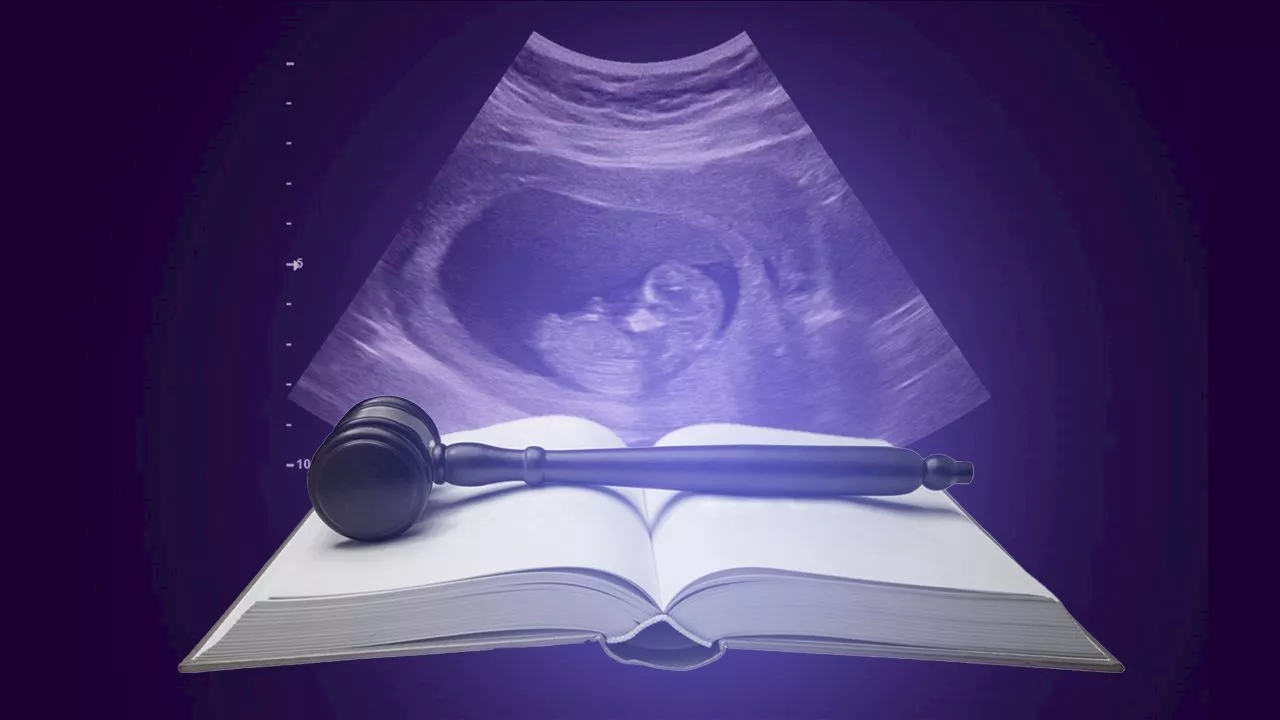 [Dash of SAS] Making abortion a constitutional right