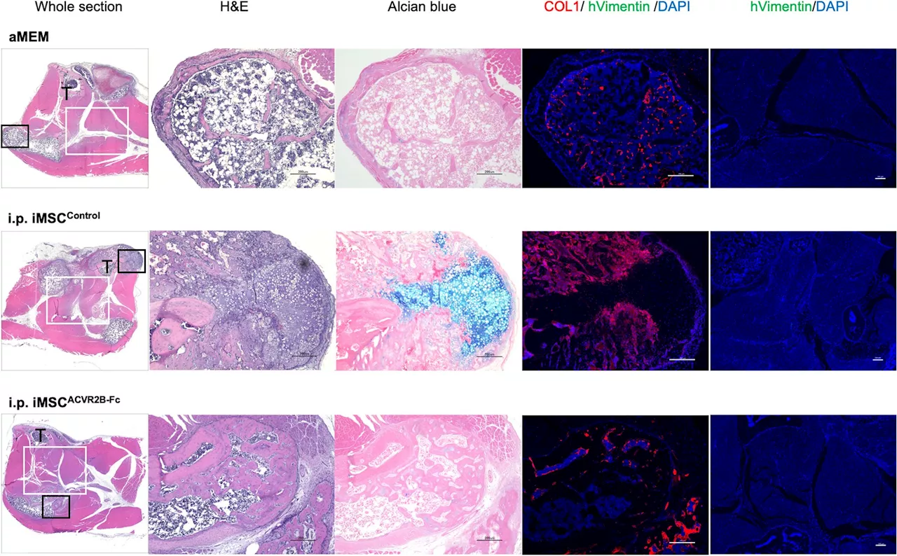 Instructing iPS cell-derived mesenchymal stem cells to inhibit abnormal bone formation in FOP