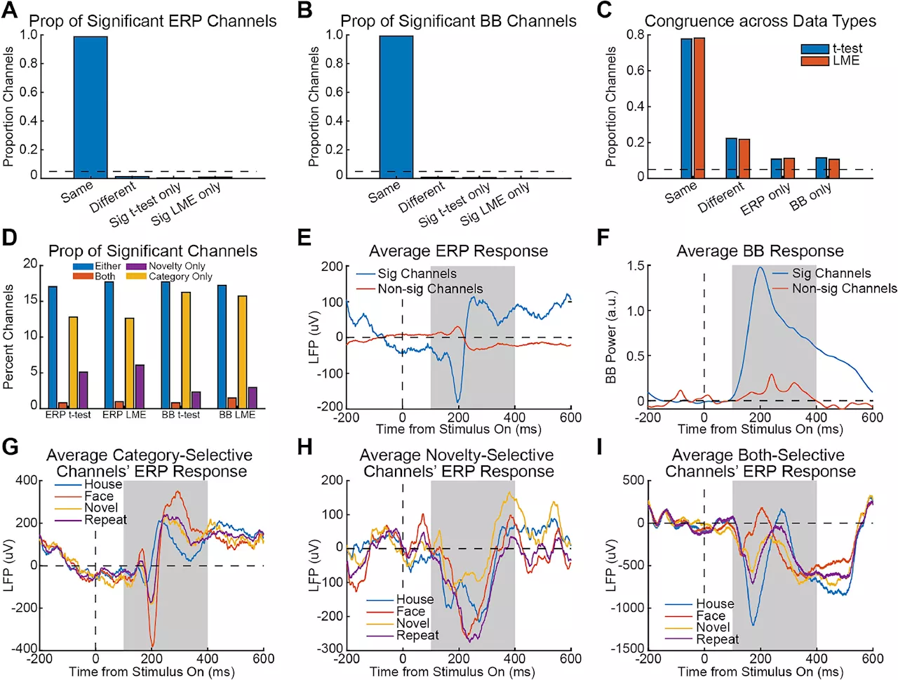 Researchers introduce enhanced brain signal analysis technique