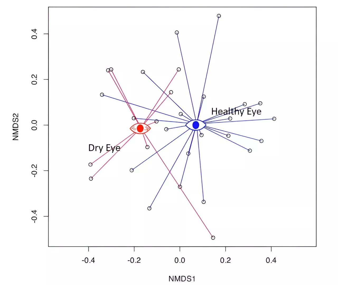 Researchers uncover the microbial secrets of dry eye