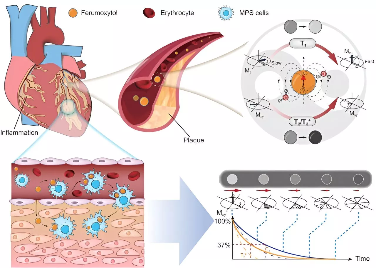 Exploring ferumoxytol: A new frontier in MRI contrast agents