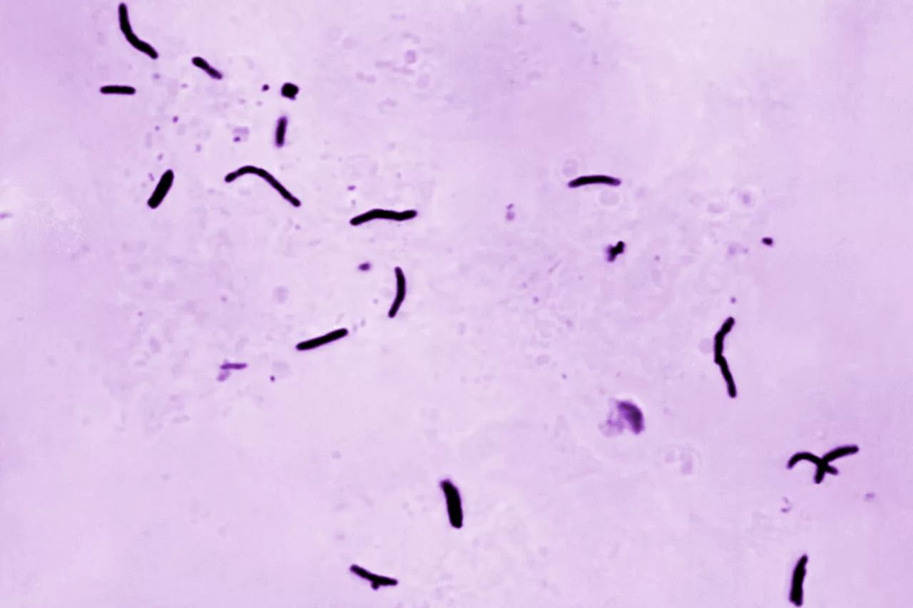 US tuberculosis cases were at their the highest level in a decade in 2023