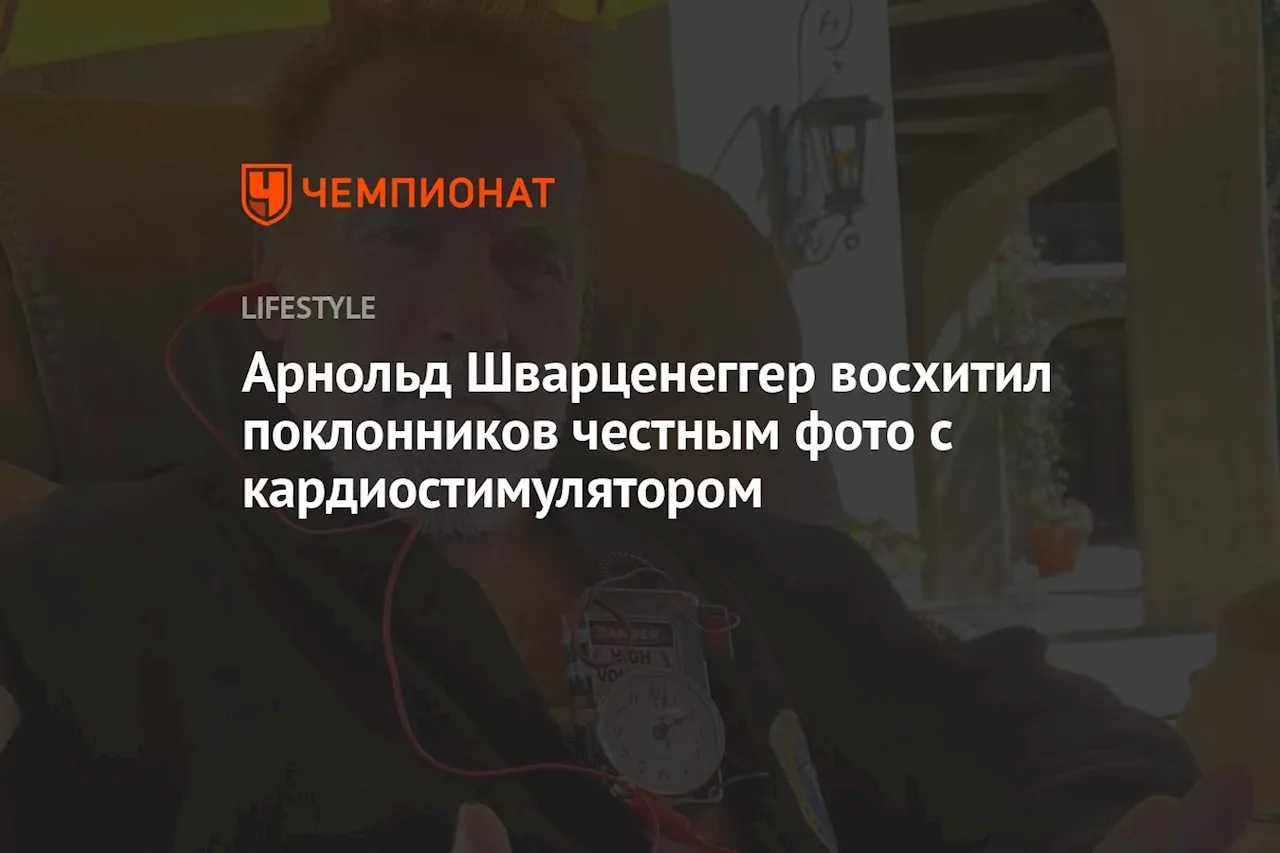 Арнольд Шварценеггер восхитил поклонников честным фото с кардиостимулятором