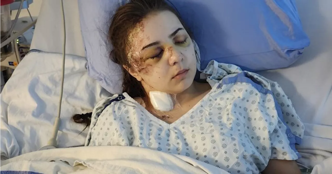 Calgary teen seriously injured in hit-and-run collision faces uncertain future