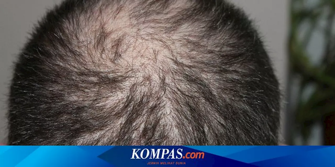 Perancis Setujui RUU Larangan Diskriminasi Berdasarkan Gaya Rambut