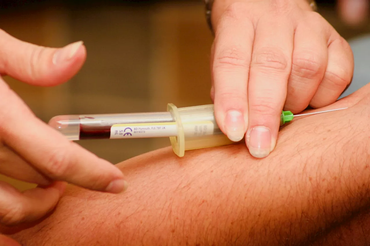 Scientists have a new tool in the race to improve the diagnosis and prognosis of sepsis