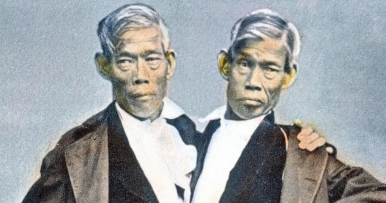 Conjoined twins Chang and Eng who had 21 children between them