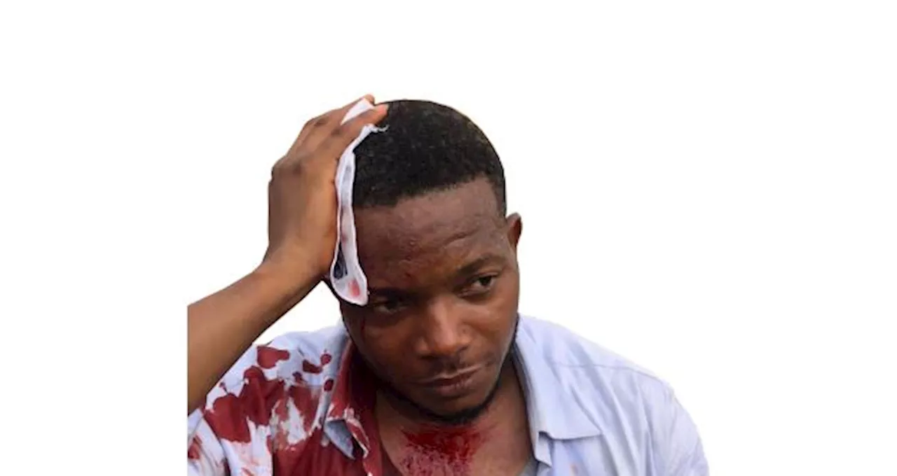 Journalists condemn alleged attack on colleague by DSS in Ibadan