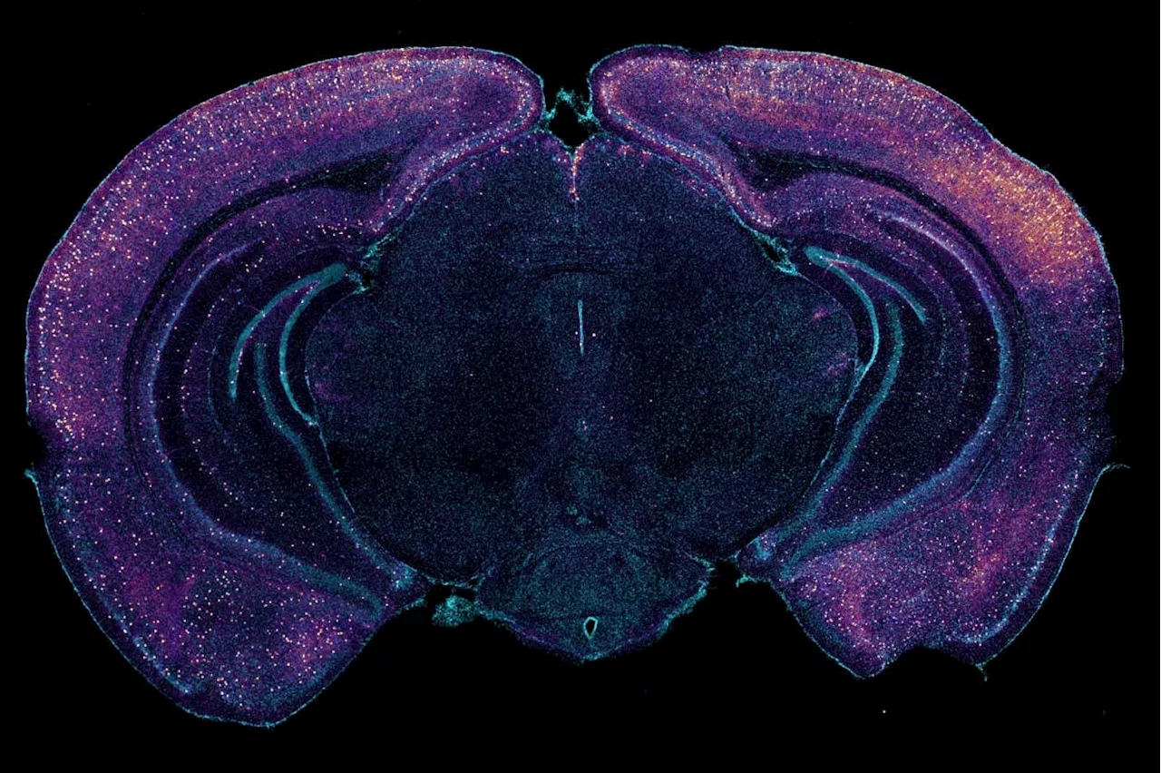 Light and sound may slow Alzheimer’s by making the brain remove toxins