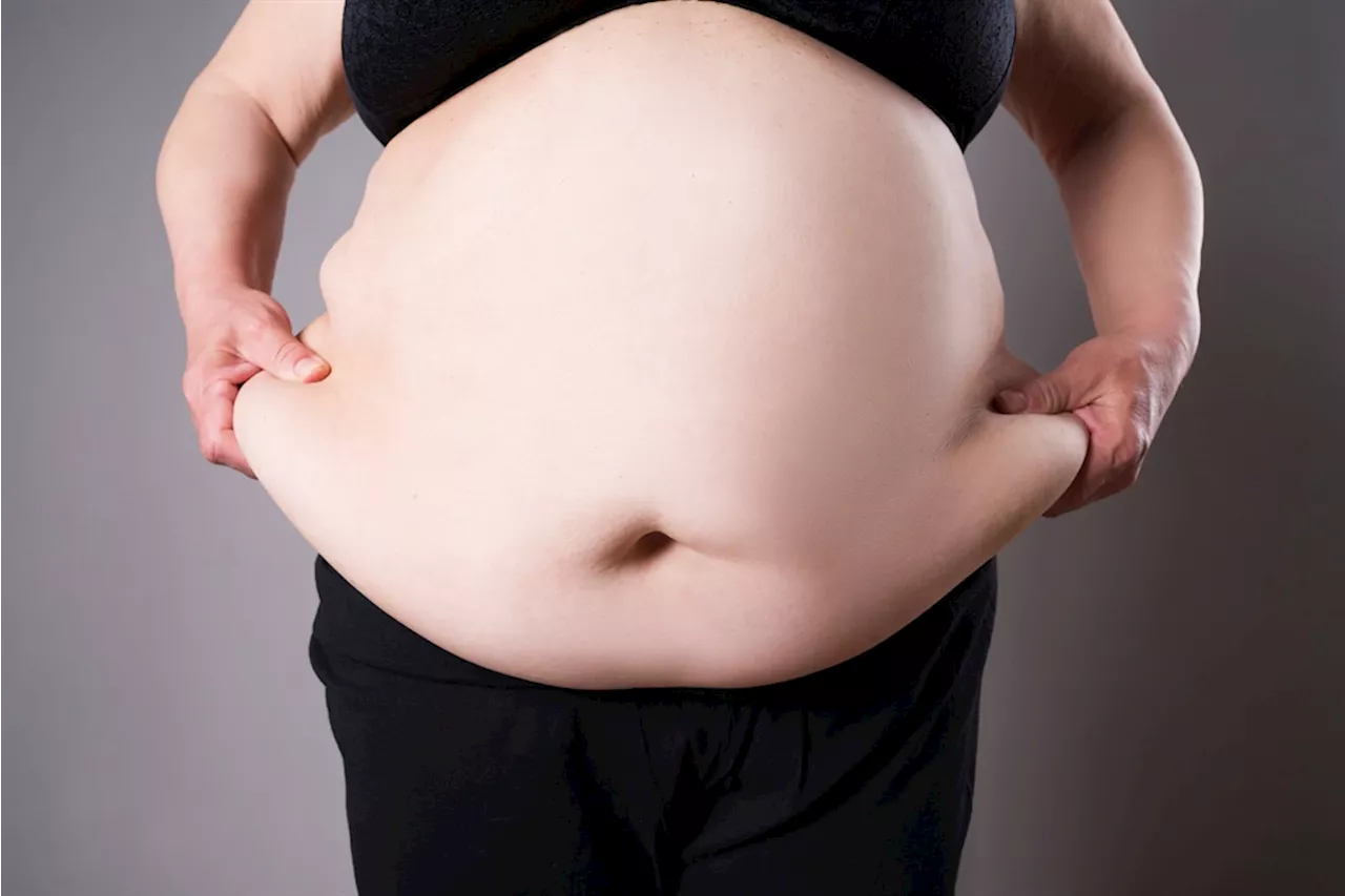 'You can't be fat and pregnant', doctor warns on World Obesity Day