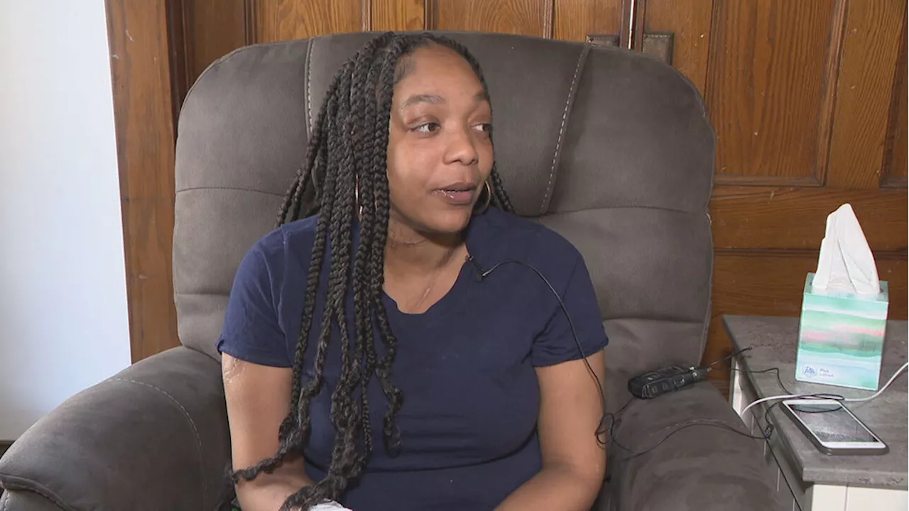 'If you can go, go': Domestic violence survivor recounts horrific attack in Rochester