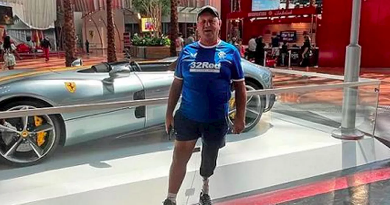 Scots dad barred from world’s fastest roller­coaster over his prosthetic leg