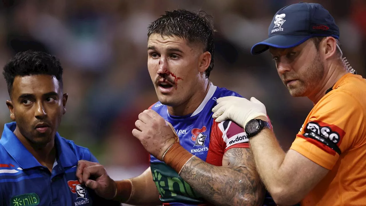 ‘Awkward and scary’: Warriors’ nervous wait after hooker blow — NRL Casualty Ward