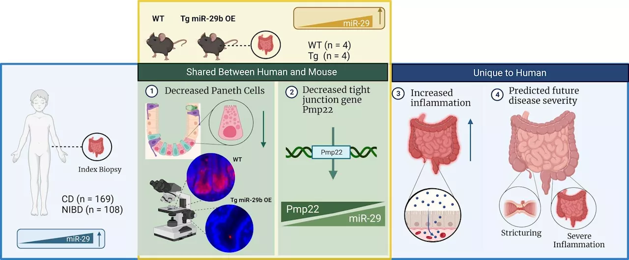 Study finds microRNA can predict severe Crohn's disease in children