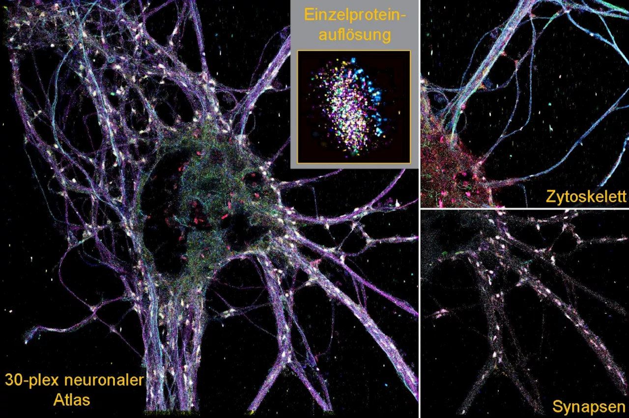 Molekülgenau auflösende 3D-Darstellung bringt neue Art von Synapsen ans Licht