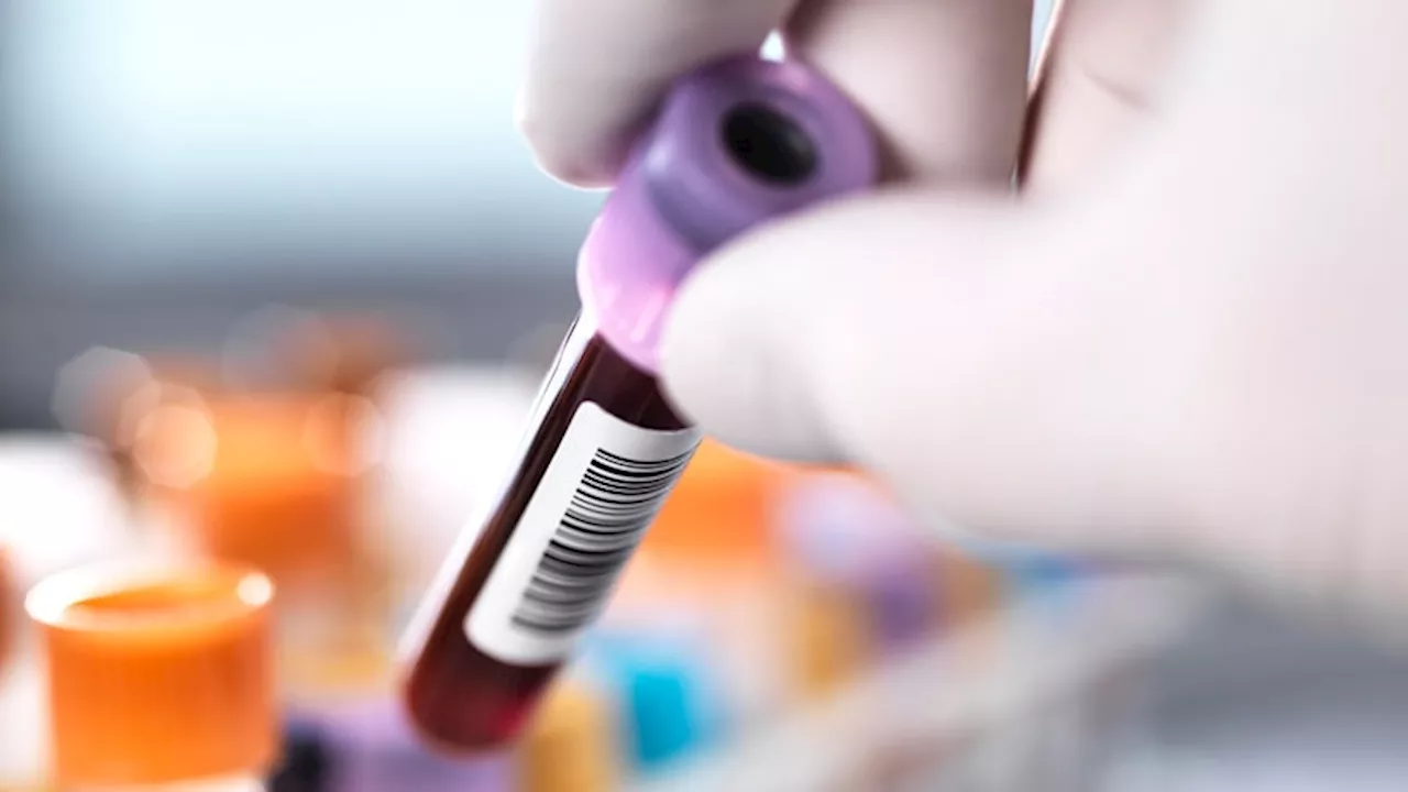 Liquid Biopsy Has Near-Perfect Accuracy for Early Pancreatic Cancer