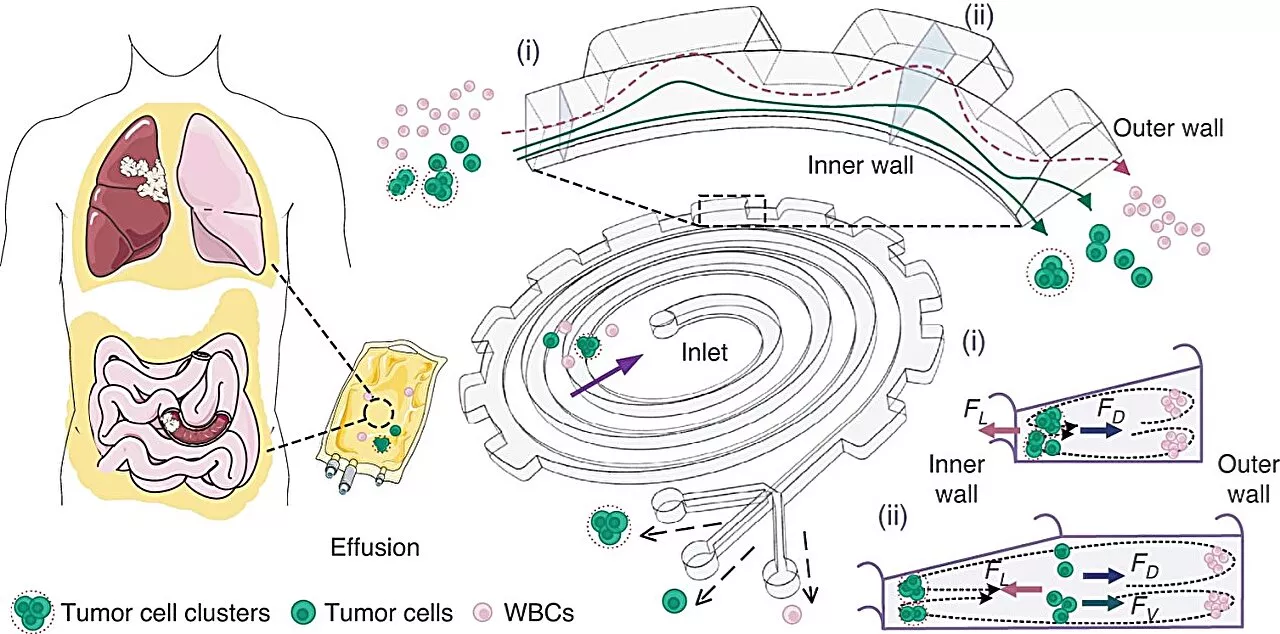 New microfluidic device for cancer detection achieves precise separation of tumor entities