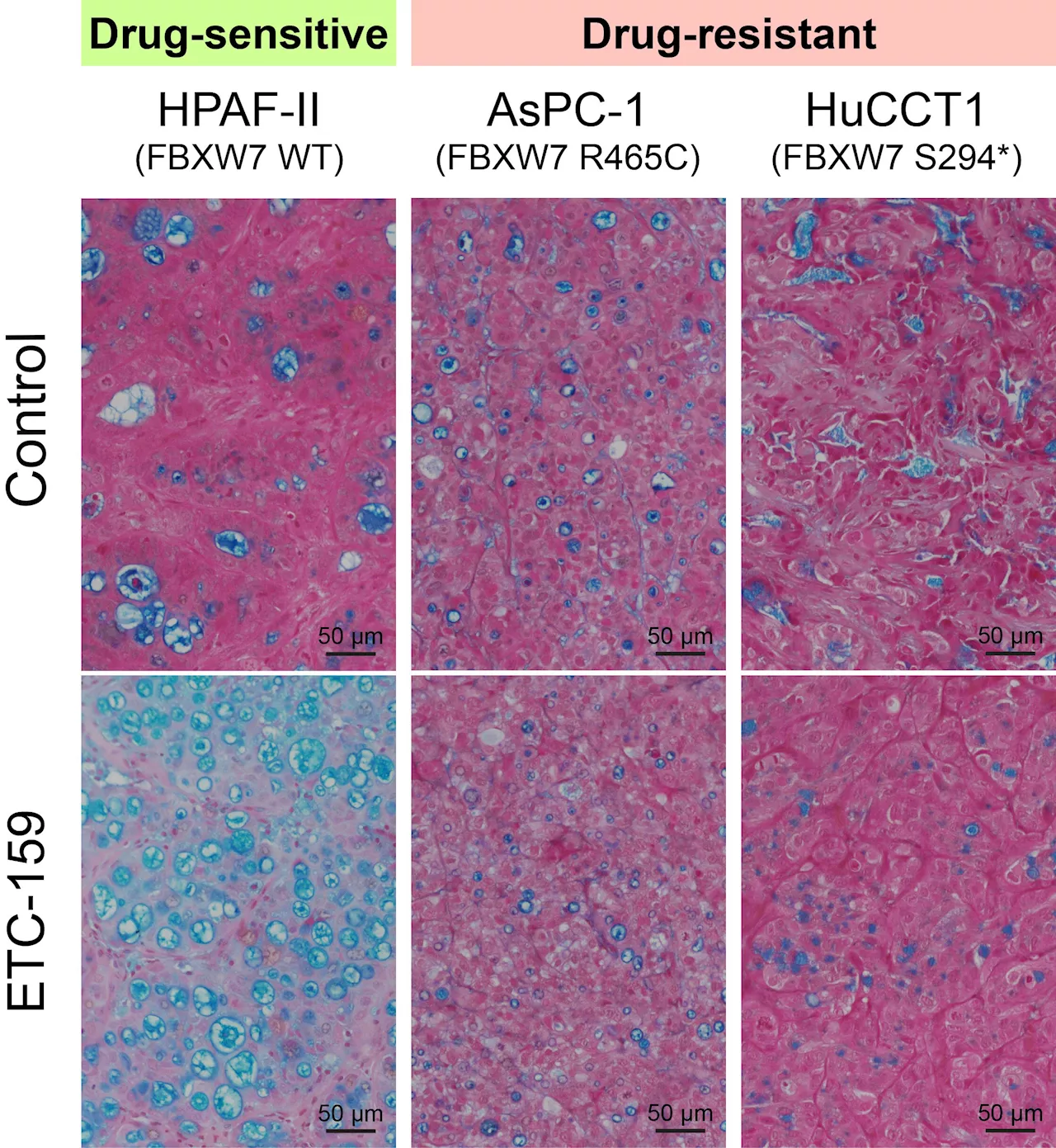 Scientists uncover key resistance mechanism to Wnt inhibitors in pancreatic and colorectal cancers