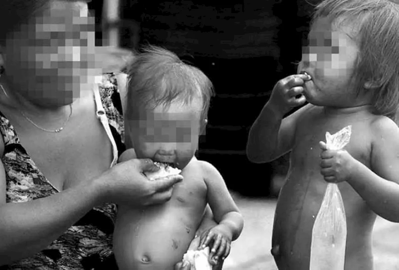 LGUs urged to step up malnutrition intervention