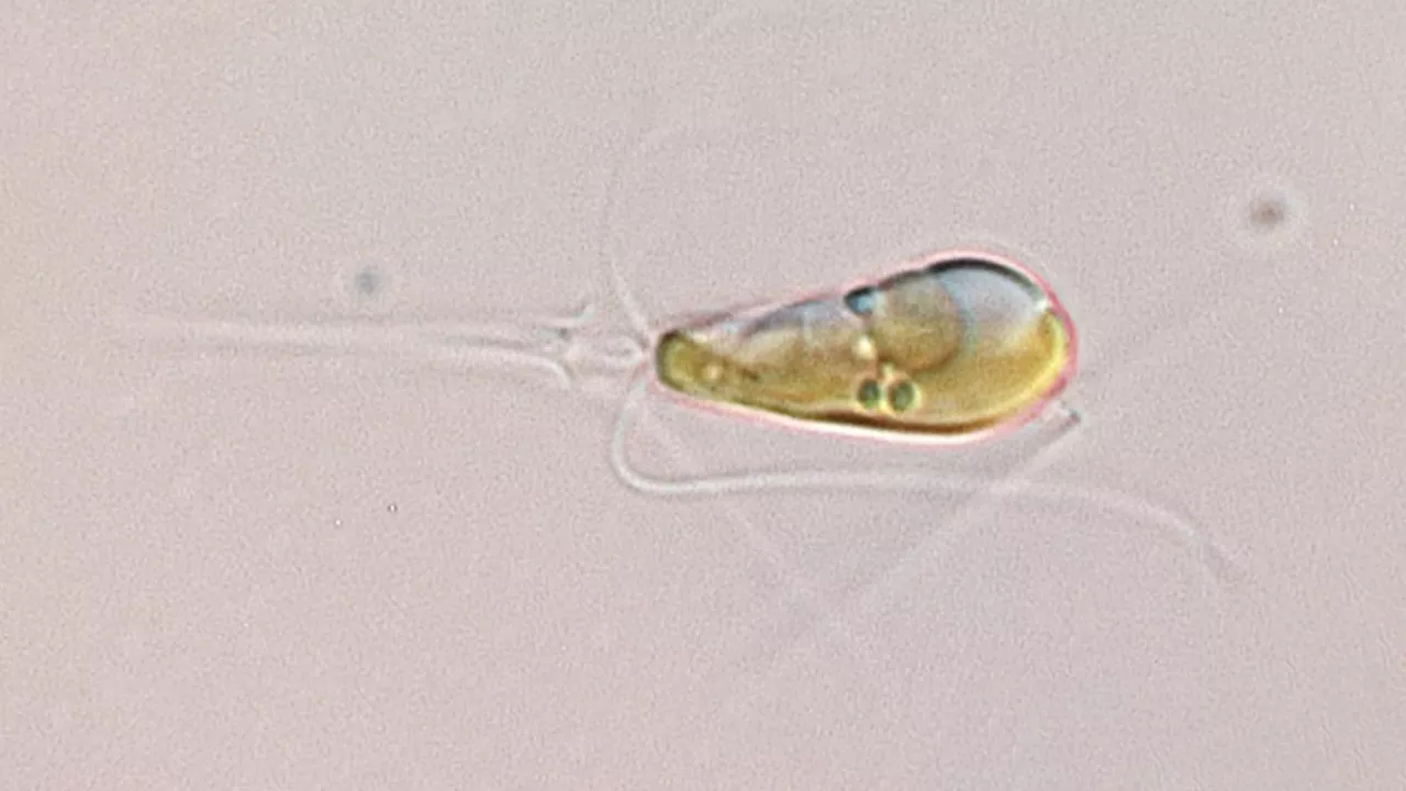 Nitroplast: the first algae to convert nitrogen into a usable form