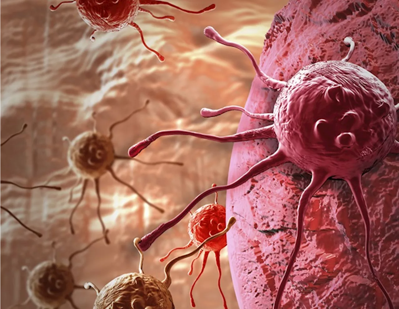 New microfluidic device improves the separation of tumor cells and clusters from malignant effusions