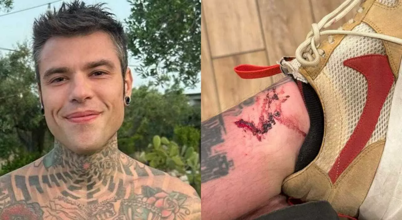 Fedez si ferisce alla caviglia durante il festival Coachella