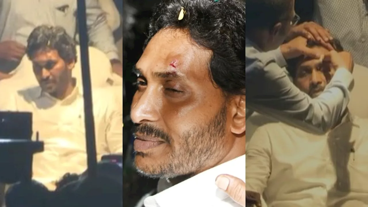 CM YS Jagan: సీఎం వైఎస్ జగన్ బస్సు యాత్రకు బ్రేక్.. నుదుటి భాగంలో కుట్లు పడే అవకాశం.?..