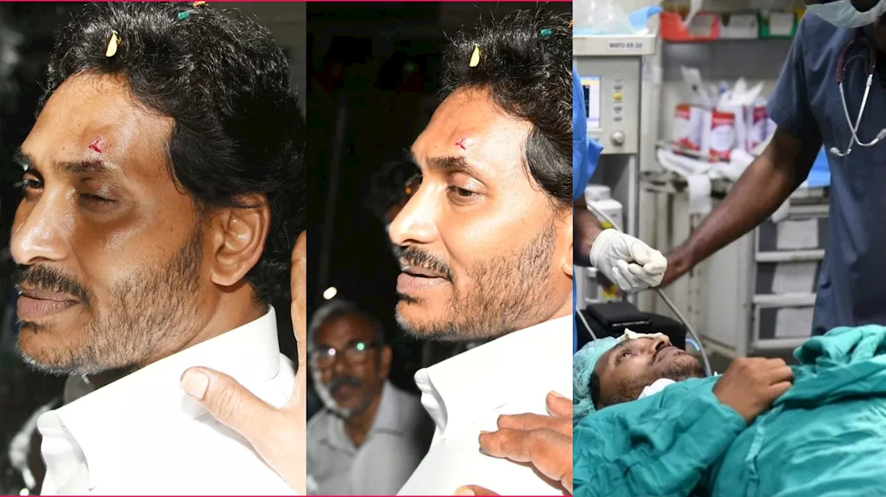 Jagan Attack: జగన్‌పై దాడి పక్కా ప్లాన్‌? లేదా స్టంట్‌.. ఘటనపై అనుమానాలు ఇవే..