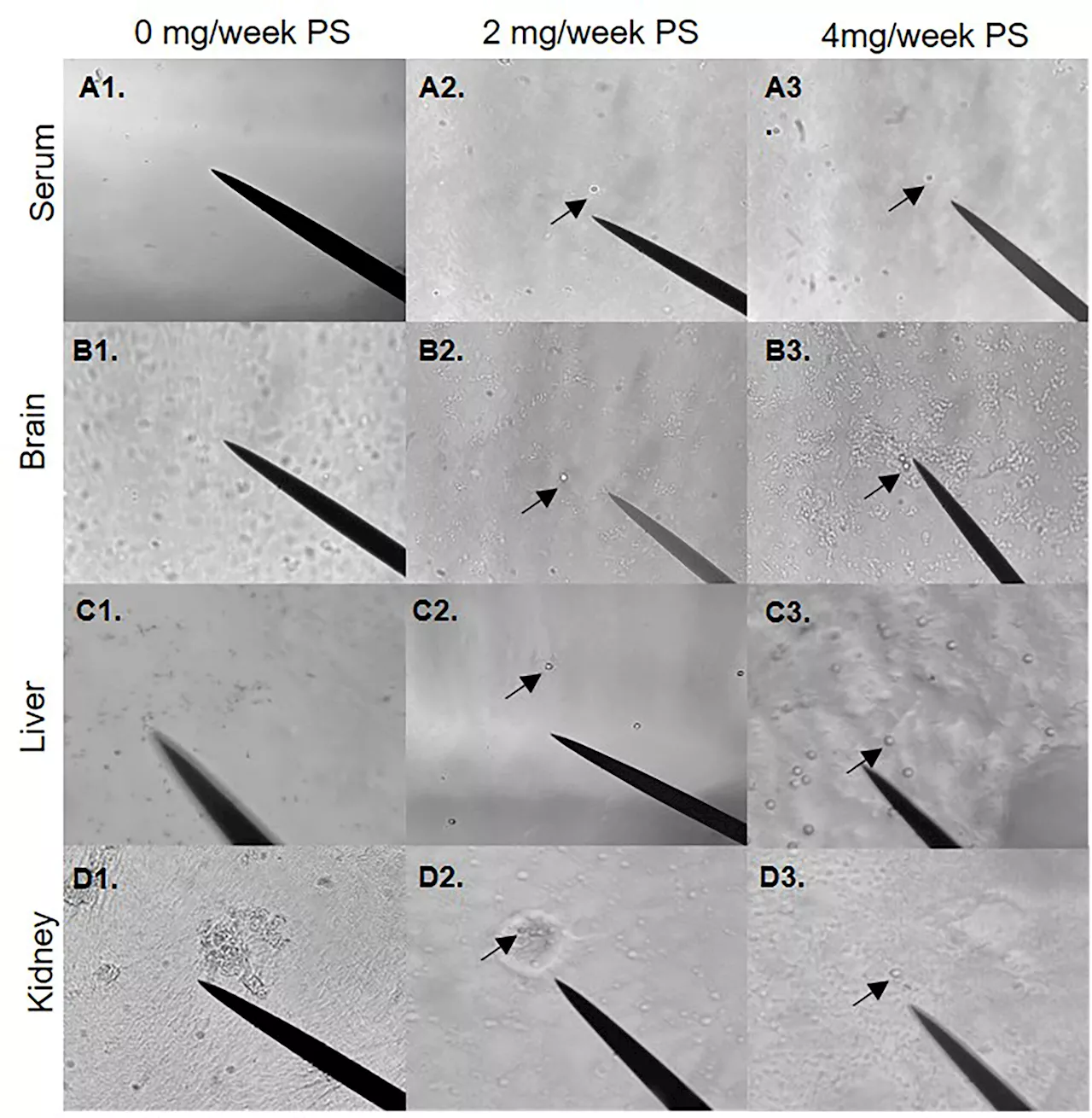 Microplastics make their way from the gut to other organs, researchers find