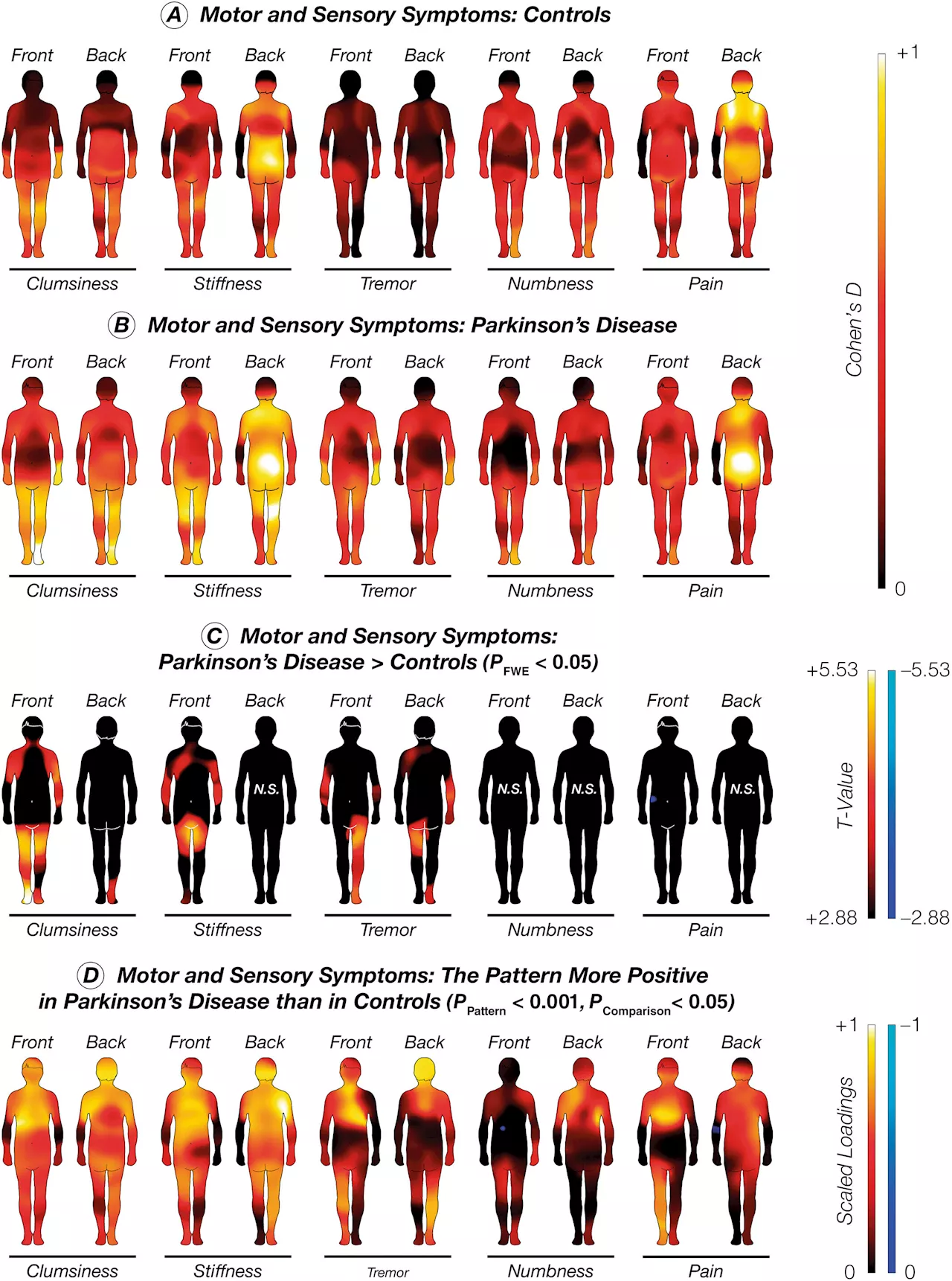 Stirring up emotions: Parkinson's disease alters emotion-related bodily sensations, finds study