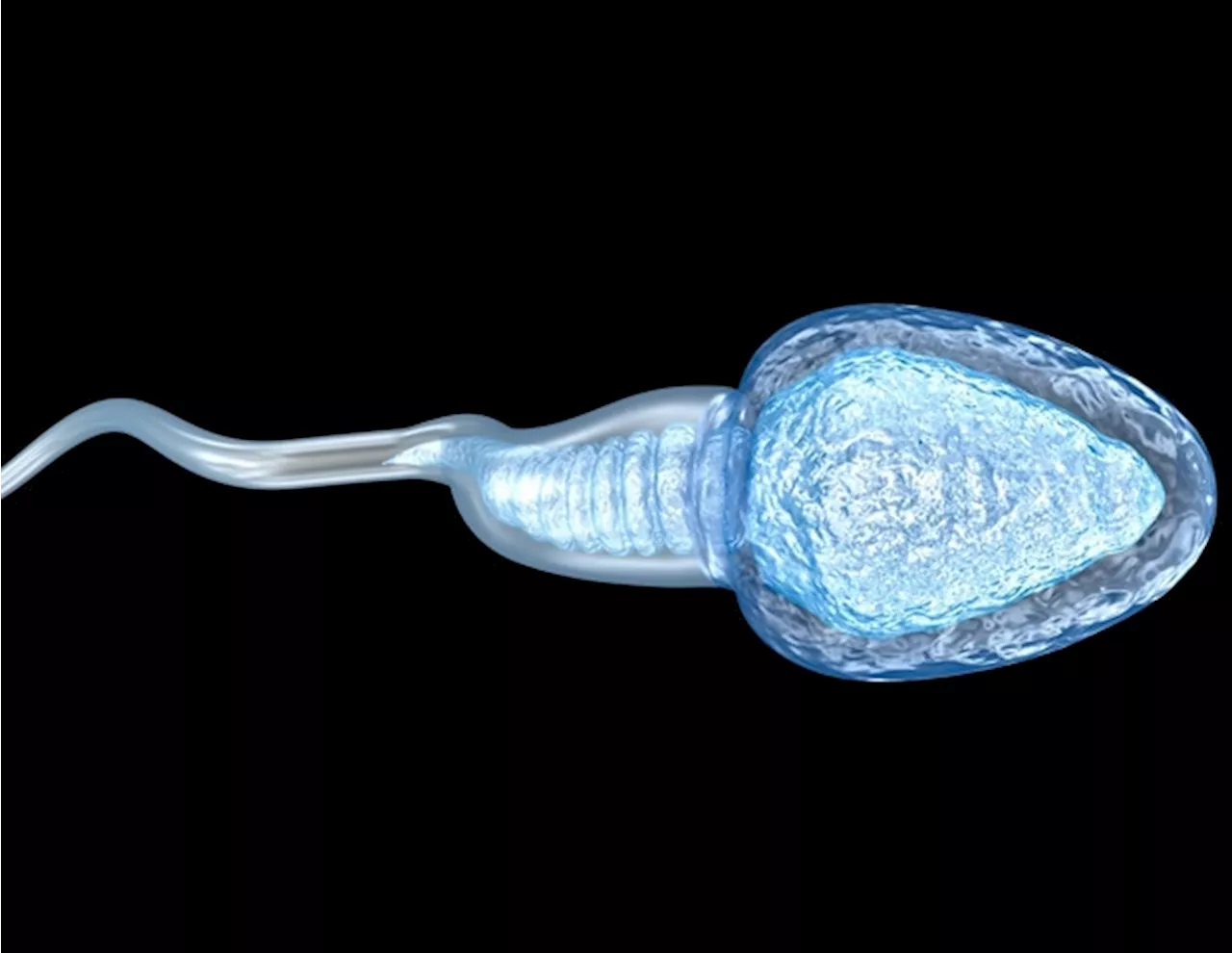 Genetic Defects Linked to Male Infertility