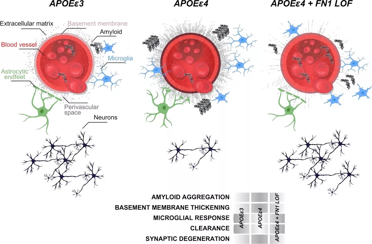 Study unlocks genetic secrets in APOEε4 carriers that could defend against Alzheimer's