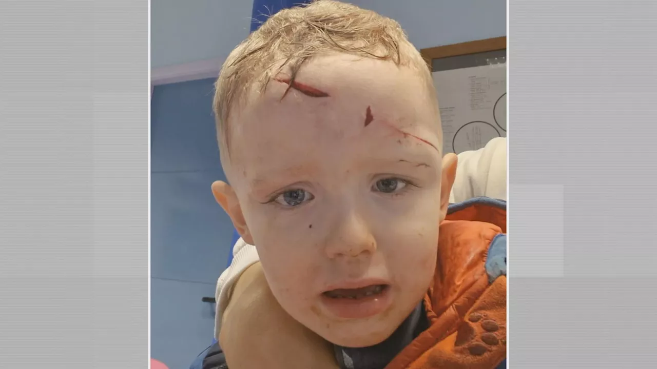 Mum devastated after toddler son attacked by a dog in north Belfast