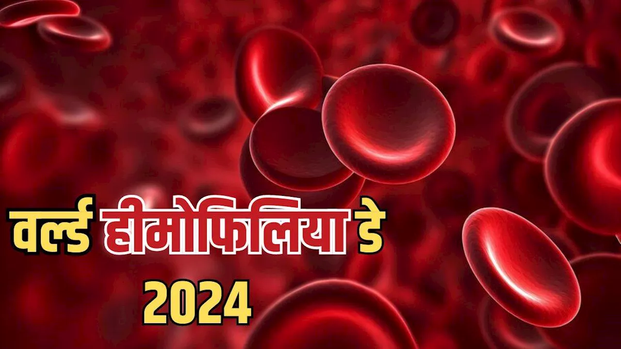 क्या है Hemophilia जो बन सकता है ब्लीडिंग का कारण, एक्सपर्ट से जानें इसके लक्षण, कारण और बचाव के तरीके