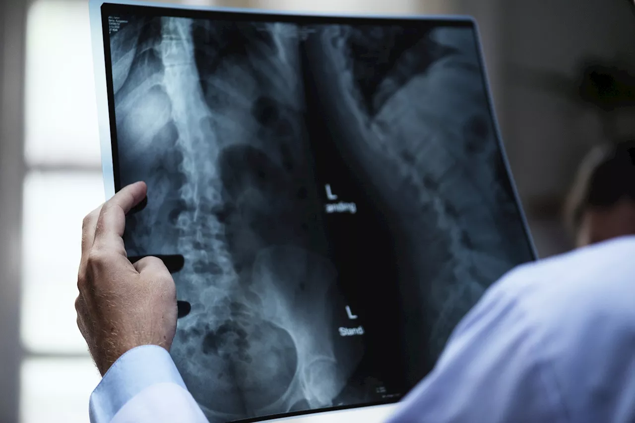 GPT-4 matches radiologists in detecting errors in radiology reports
