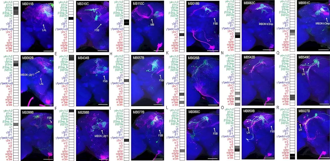 Human brains and fruit fly brains are built similarly—researchers are studying the differences