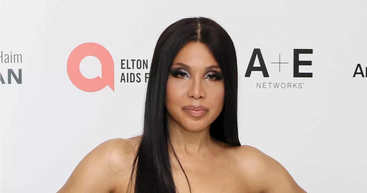 Toni Braxton Says She ‘Worked Hard’ to ‘Hide’ Her Lupus Diagnosis