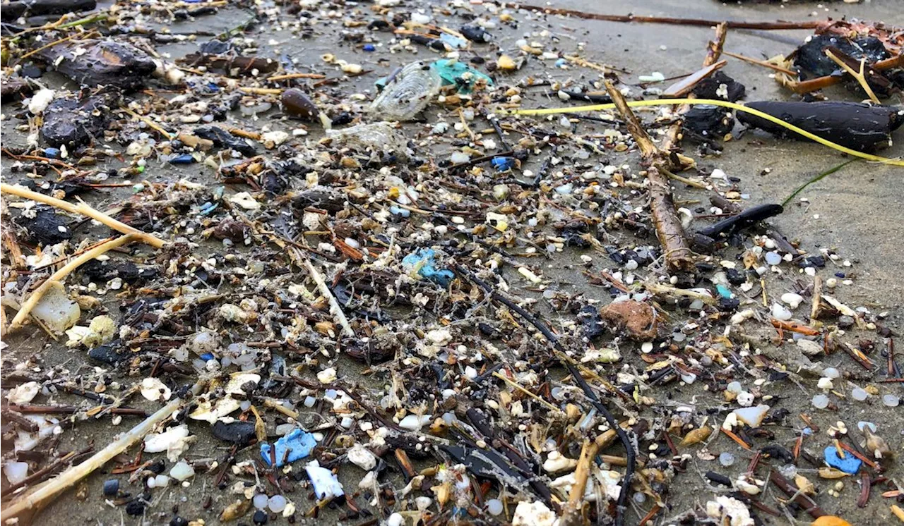 You probably already have microplastics in your brain, study finds