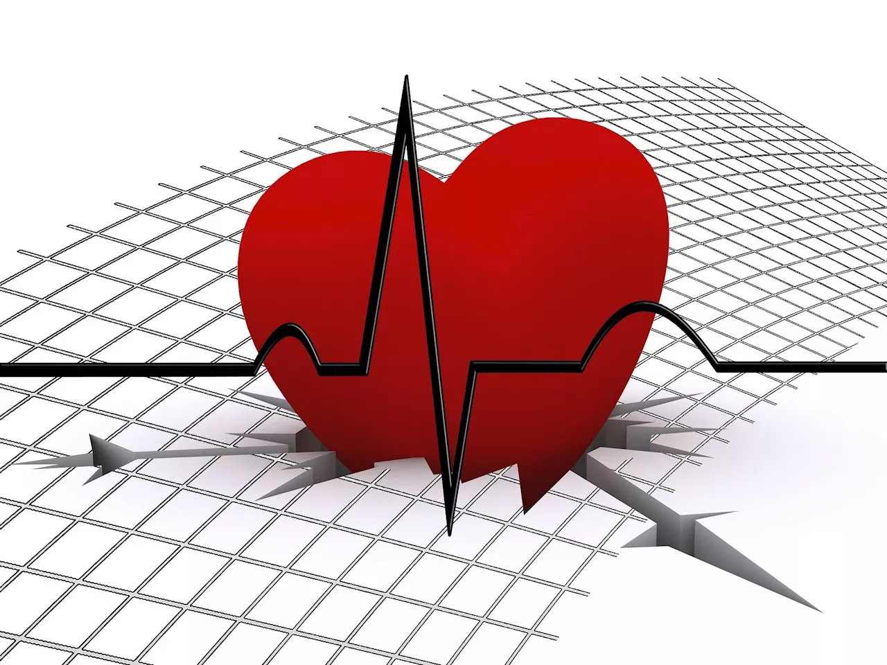 Adults with congenital heart disease face higher risk of abnormal heart rhythms