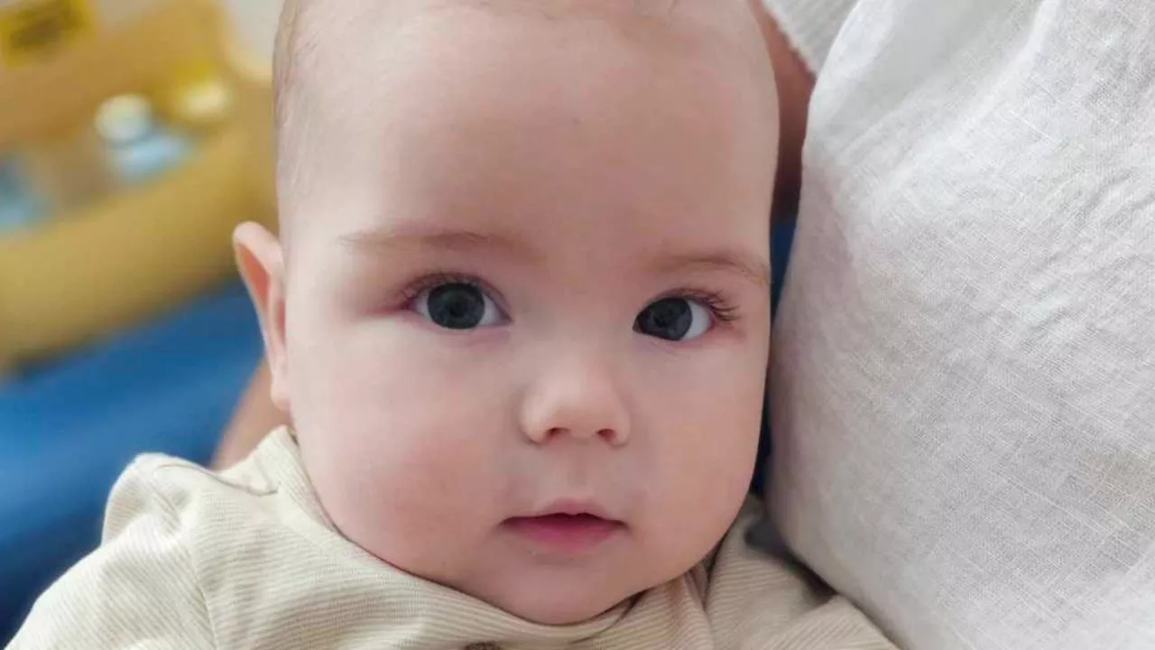 ‘Brave’ baby fights rare syndrome